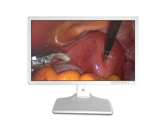 Màn hình phụ kiện nội soi y tế 32 inch