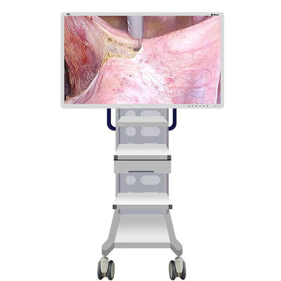 Camera giám sát nội soi y tế với màn hình 55 inch