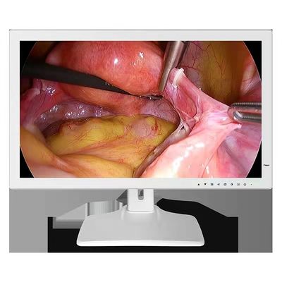Màn hình y tế nội soi 1980x1200 RGBS 24 inch