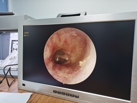 Màn hình 22 inch Tích hợp hệ thống camera nội soi ENT Full HD Di động