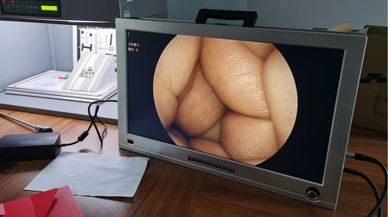 Màn hình 22 inch Tích hợp hệ thống camera nội soi ENT Full HD Di động