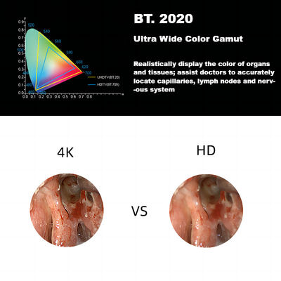 DEC 3840A Hệ thống camera nội soi y tế 4K Ultra HD mới dành cho nội soi